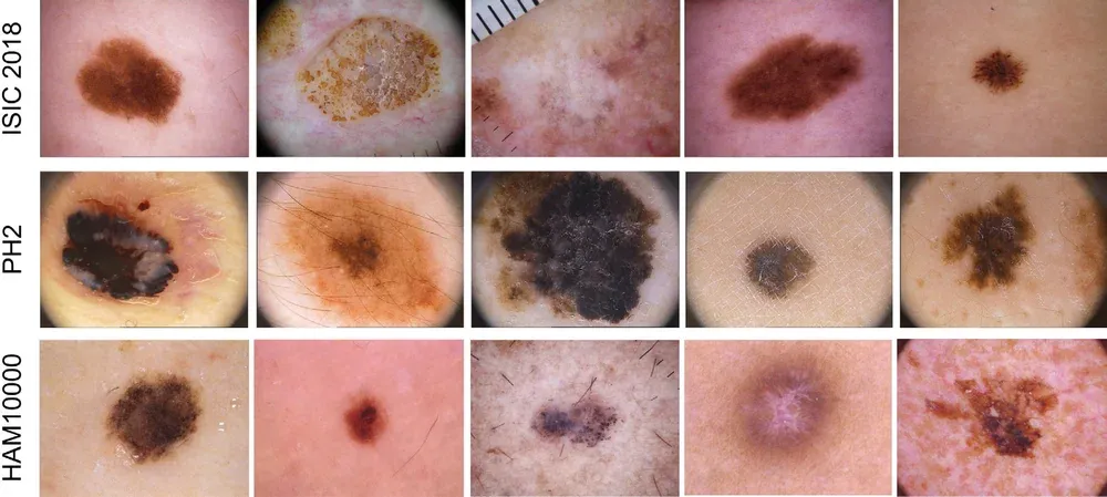 Figure 3 from “MRLSA-Net: An attention-enhanced framework for robust skin lesion segmentation”